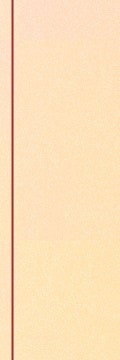 고속터미널역 문신제거, 깨끗하게 지우는 방법 사진 33