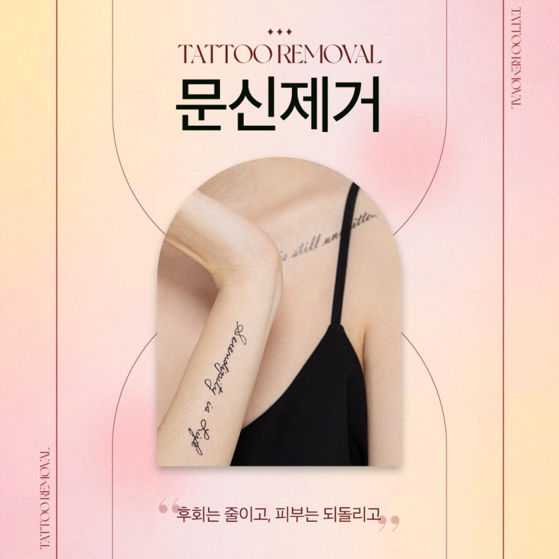 고속터미널역 문신제거, 깨끗하게 지우는 방법 사진 2