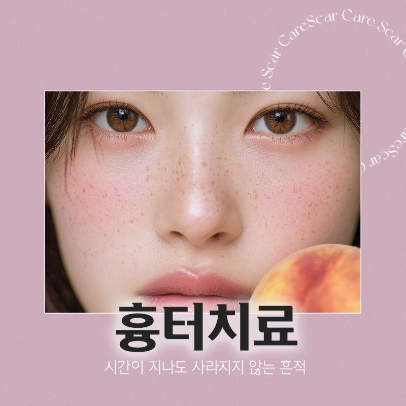 고속터미널역흉터치료,정확한 진단과 세밀한 관리 필요 사진 2