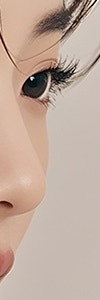 기미·잡티·오타모반까지, 방배색소치료 사진 21