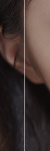 다양한 색소질환을 한번에, 신반포역색소치료 사진 16