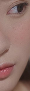 다양한 색소질환을 한번에, 신반포역색소치료 사진 19