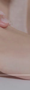 다양한 색소질환을 한번에, 신반포역색소치료 사진 29