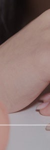 다양한 색소질환을 한번에, 신반포역색소치료 사진 26