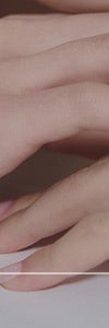다양한 색소질환을 한번에, 신반포역색소치료 사진 27