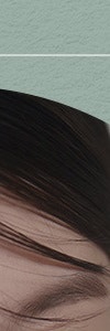 다양한 색소질환을 한번에, 신반포역색소치료 사진 10