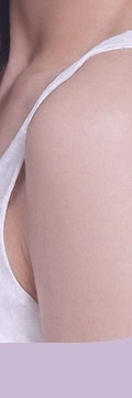 반포동울트라콜, 탄력 관리로 선택되는 이유 사진 25