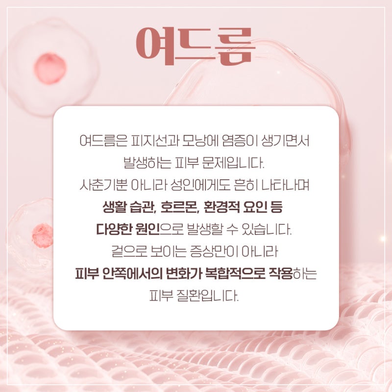 방배여드름치료가 필요한 경우에는