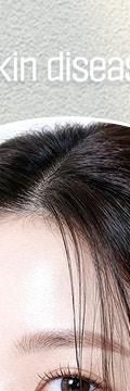 고속터미널피부질환 가렵고 따가운 증상, 무시하면 안 되는 이유? 사진 11