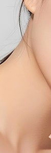 고속터미널역색소치료 재발하지 않으려면 사진 16
