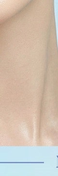 고속터미널줄기세포, 근본적인 안티에이징의 시작 사진 32