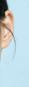 고속터미널줄기세포, 근본적인 안티에이징의 시작 사진 24