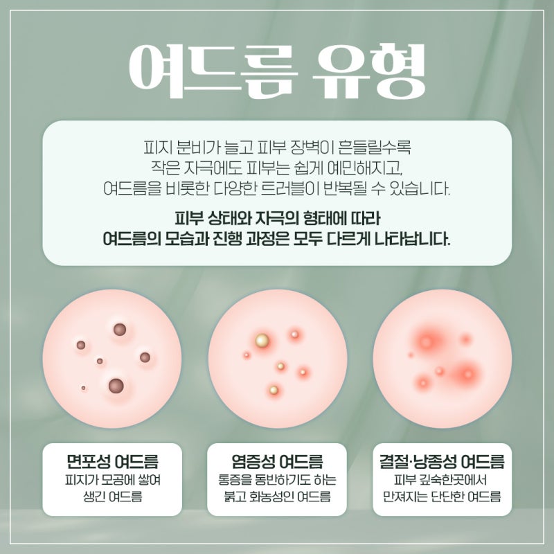 고속터미널역여드름 치료, 상태에 따른 접근이 핵심! 사진 4