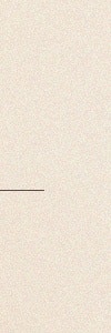 반포동써마지, 처지고 늘어진 피부가 신경쓰일 때 사진 15