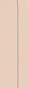 반포동써마지, 처지고 늘어진 피부가 신경쓰일 때 사진 32
