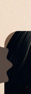 반포동써마지, 처지고 늘어진 피부가 신경쓰일 때 사진 10
