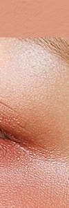 방배색소치료, 선택과 관리가 중요한 이유는 사진 12