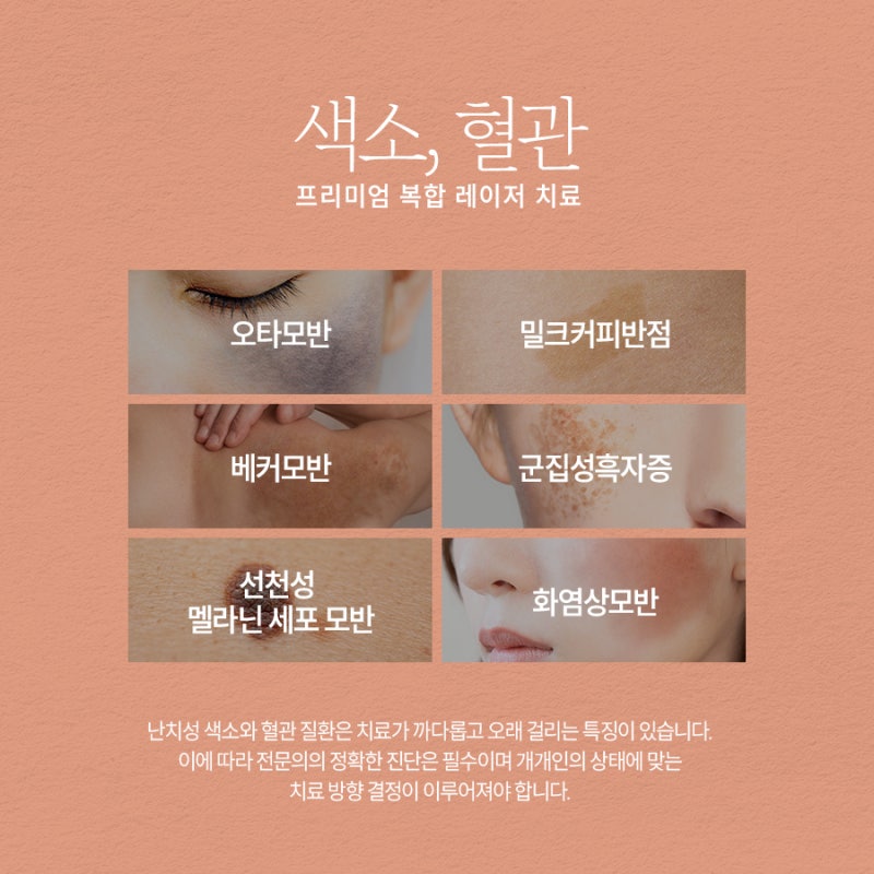 방배색소치료, 선택과 관리가 중요한 이유는