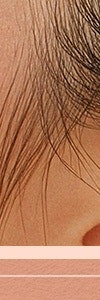 방배색소치료, 선택과 관리가 중요한 이유는 사진 23