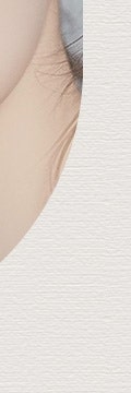 꺼진 볼륨을 다시 살리고 싶다면, 고속터미널피부과 울트라콜 사진 27