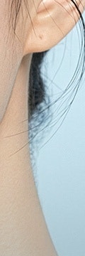 근본적인 피부 문제 해결을 위한, 서초리투오 사진 22
