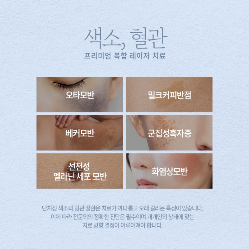 신반포역색소치료, 난치성색소치료법과 치료시기 가이드