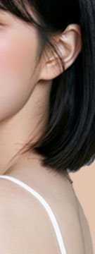 고속터미널역흉터치료, 초기 대응이 결과를 좌우하는 이유 사진 20