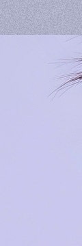 반포스컬트라, 꺼진 볼살과 처진 라인이 걱정이라면? 사진 6
