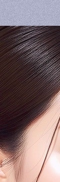 반포스컬트라, 꺼진 볼살과 처진 라인이 걱정이라면? 사진 8