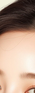 고속터미널리프팅으로 환절기 얼굴, 바디라인 관리를 한 번에 사진 8