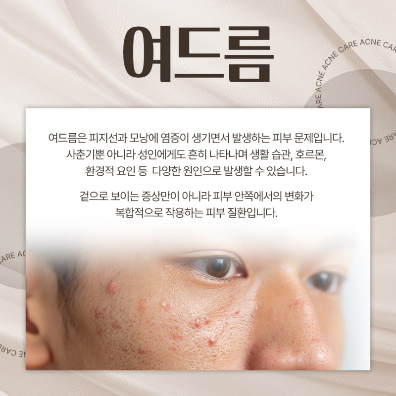 반포여드름치료 고민되는 순간