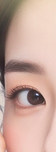 서초기미치료, 근본적인 문제 해결이 중요한 이유 사진 16