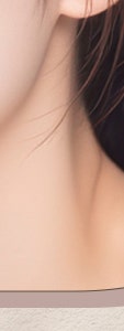 서초기미치료, 근본적인 문제 해결이 중요한 이유 사진 27