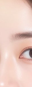 방배흉터치료 전, 고려해야할 부분 정리 사진 18