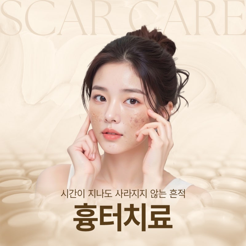 방배흉터치료 전, 고려해야할 부분 정리 사진 2