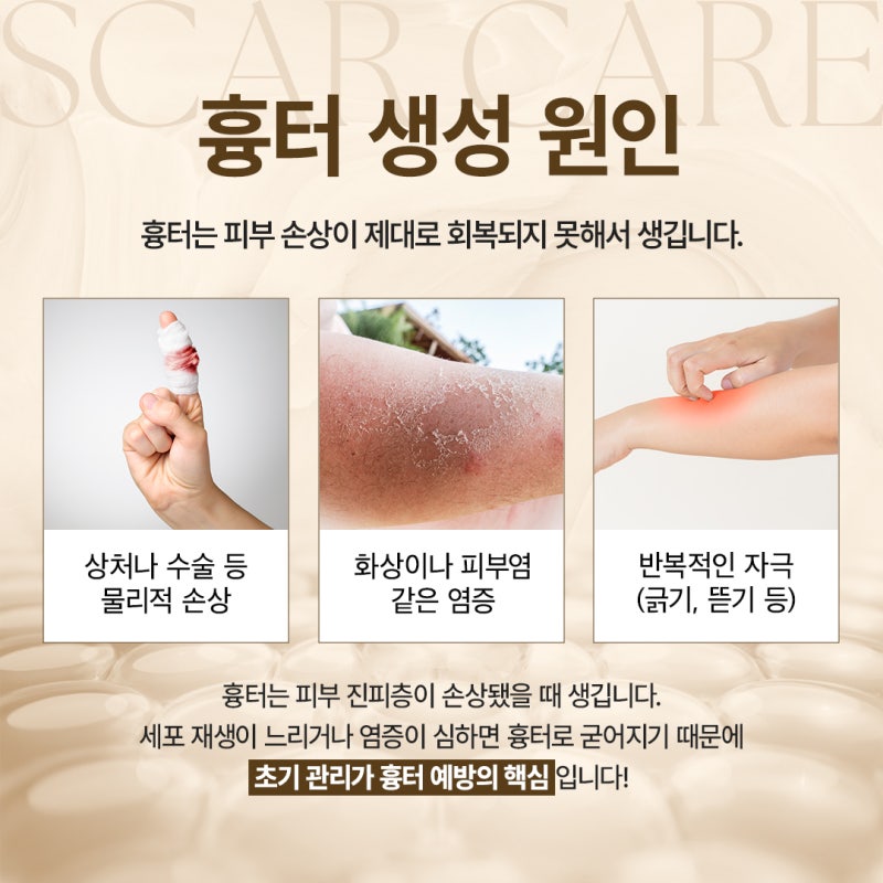 방배흉터치료 전, 고려해야할 부분 정리
