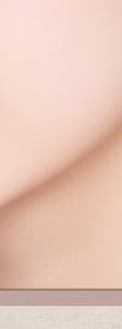 방배흉터치료 전, 고려해야할 부분 정리 사진 27