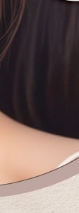 방배흉터치료 전, 고려해야할 부분 정리 사진 29