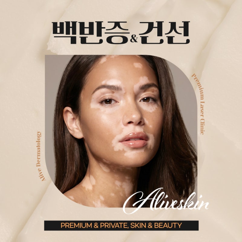 피부에 하얀 반점이 커지기 시작했다면, 동작백반증치료 사진 2
