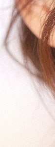 반포동울쎄라, 자연스러운 얼굴 윤곽 관리를 찾고 있다면 사진 19