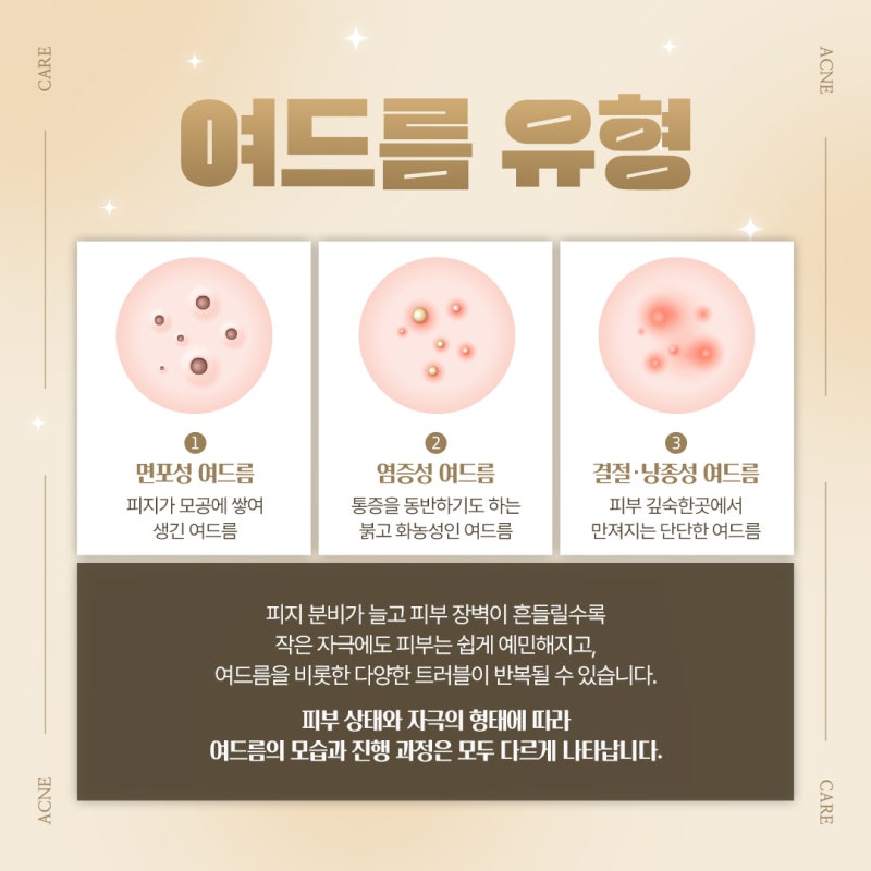 반복되는 여드름 고민을 줄이는 습관, 방배여드름프로그램 사진 4