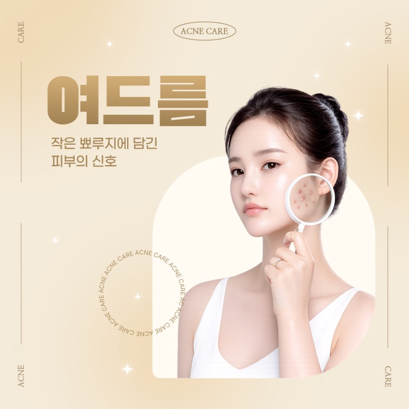 반복되는 여드름 고민을 줄이는 습관, 방배여드름프로그램 사진 2