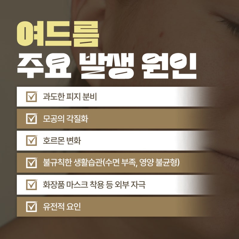 반복되는 여드름 고민을 줄이는 습관, 방배여드름프로그램 사진 5