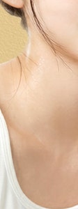 동작써마지 만족도를 좌우하는 차이점 사진 27