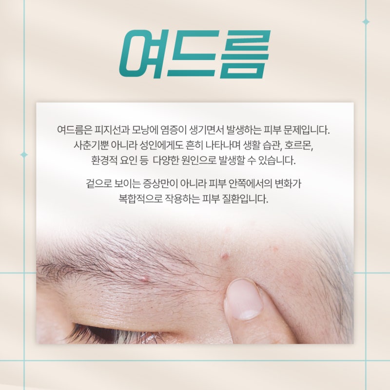 고속터미널 피부과, 여드름 피부관리 이렇게 하세요.
