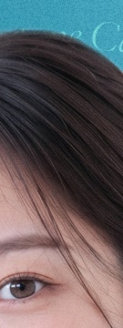 반복되는 트러블, 방배동 여드름 원인과 관리 방법 사진 12
