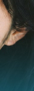 서초 기미 치료, 제대로 효과 보기 위해서는? 사진 21