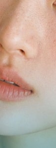 서초 기미 치료, 제대로 효과 보기 위해서는? 사진 19