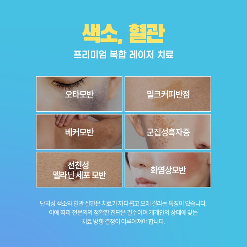 서초 기미 치료, 제대로 효과 보기 위해서는?