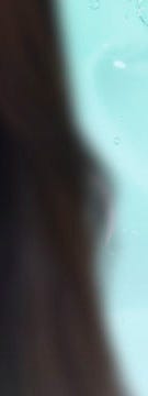 고속터미널역 스컬트라 과연 눈밑꺼짐에 효과적일까? 사진 20